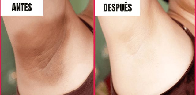 JABÓN AURORA - Efecto Aclarante de Zonas íntimas y Piel